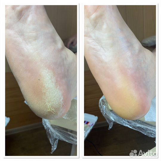 Подолог. Педикюр.Маникюр.Наращивание