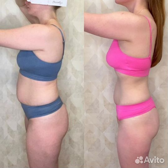 Марафон похудения