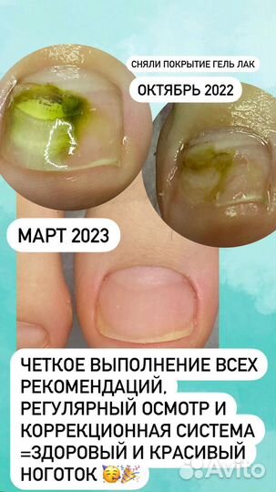 Медицинский и эстетический педикюр и маникюр