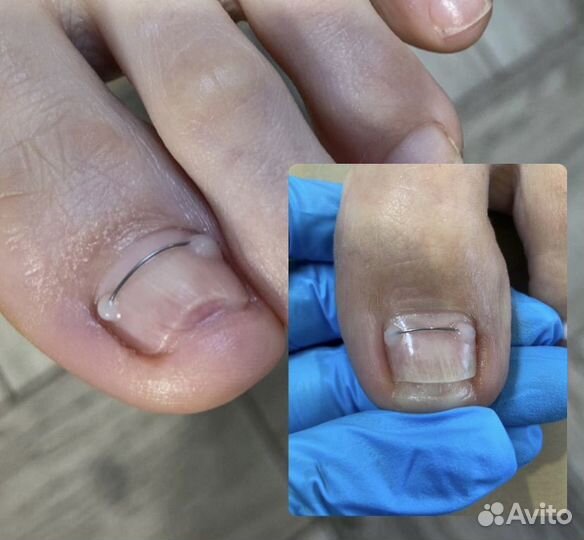Подолог / медицинский педикюр