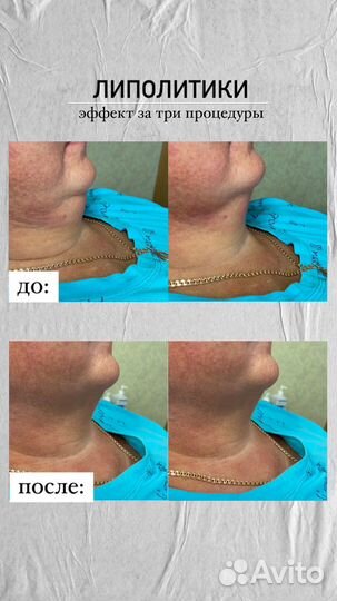 Услуги косметолога