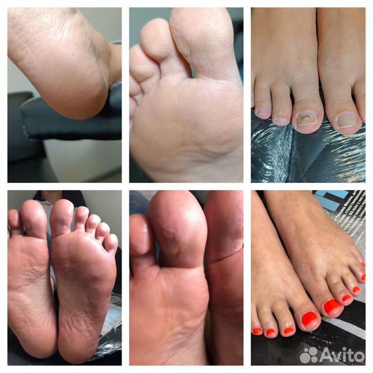 Smart педикюр