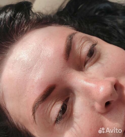 Перманентный макияж (татуаж) Удаление татуажа