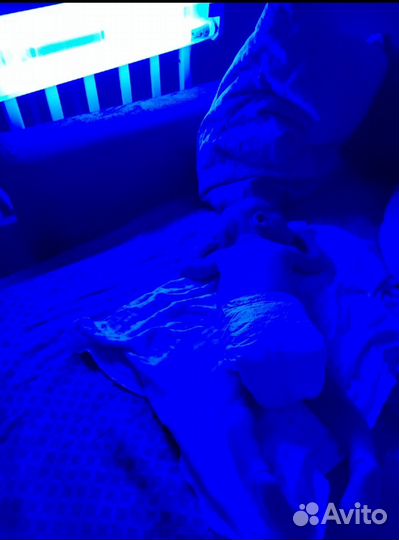 Фотолампа от желтушки