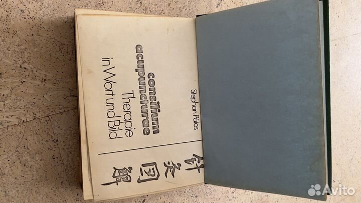 Иглоукалывание