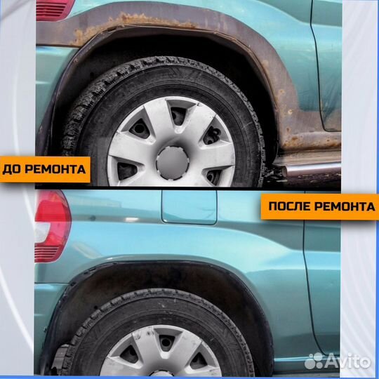 Ремонтные арки Hyundai Santa Fe 1