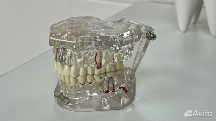 Ортопедия/ консультация ортопеда