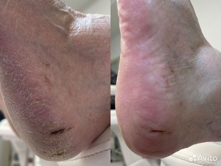 Педикюр подолог маникюр