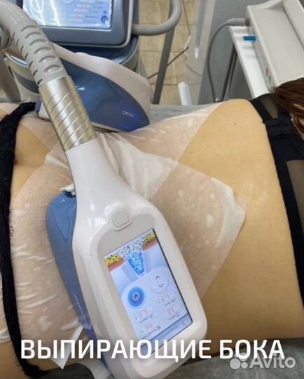 Криолиполиз RF лифтинг Кавитация Миостимуляция