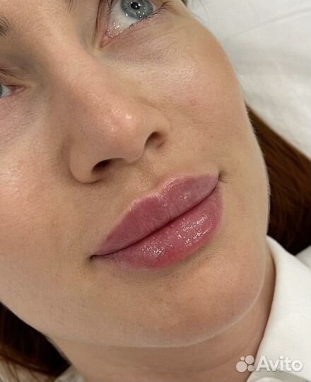 Модель на увеличение губ