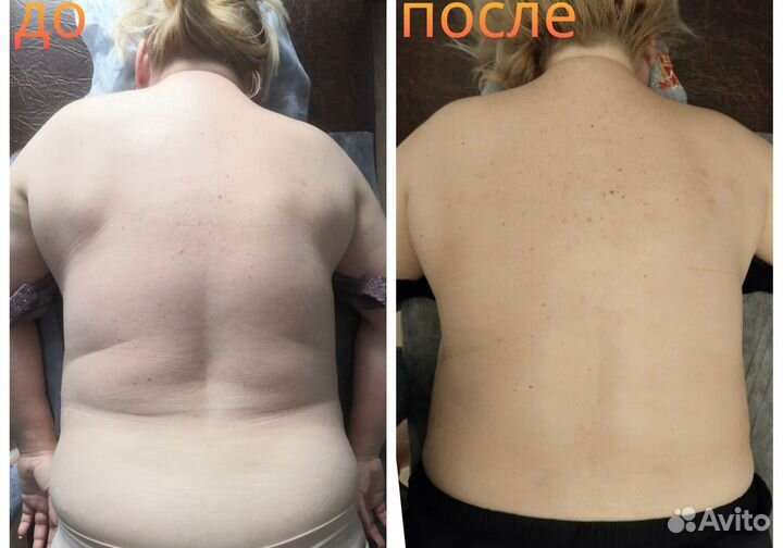 Массаж/электрофорез