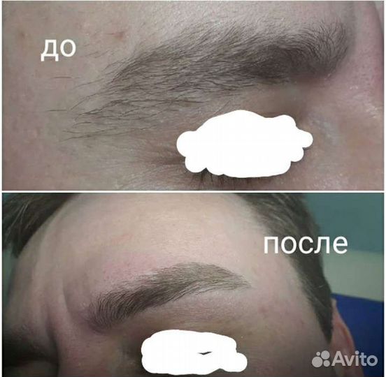 Шугаринг,депиляция воском для женщин и мужчин