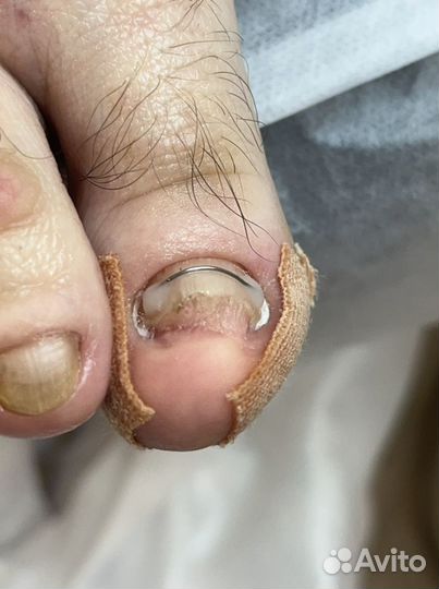 Подолог педикюр маникюр (пилочный) покрытие