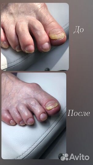 Маникюр/педикюр за час