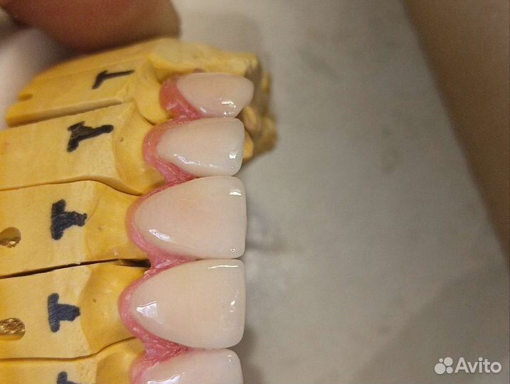 Зубоной техник