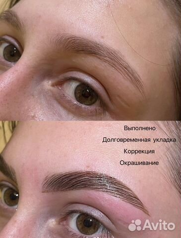 Шугаринг: руки выше локтя
