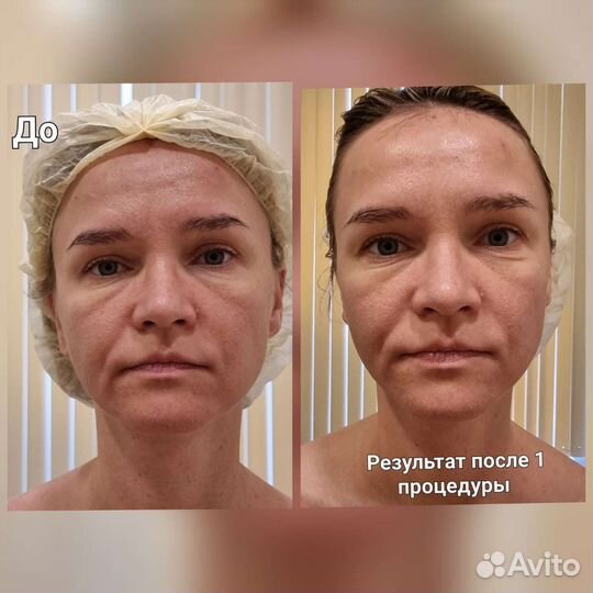 Массаж Японские техники