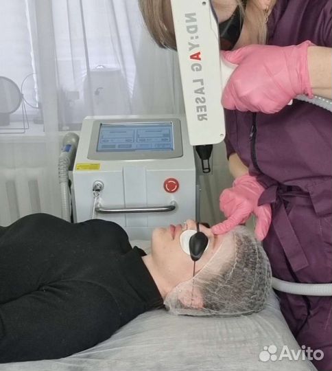 Удаление тату, удаление татуажа