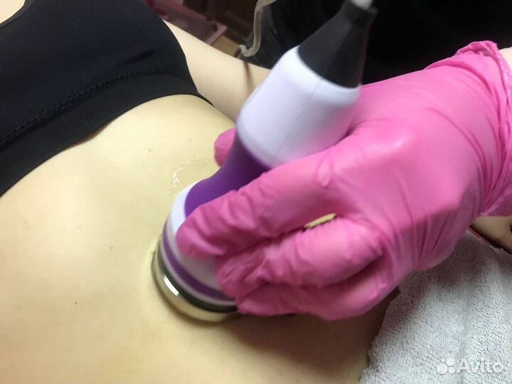 LPG массаж. Аппаратная коррекция фигуры