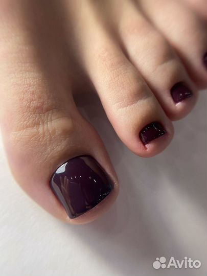 Медицинский педикюр/онихолизис/лак обычный/гель