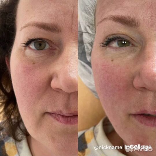 Сыворотка vl26g