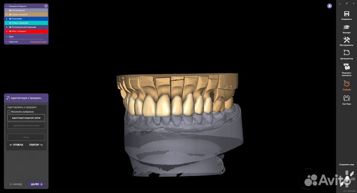 Exocad 3.1 полный комплект+бюгеля