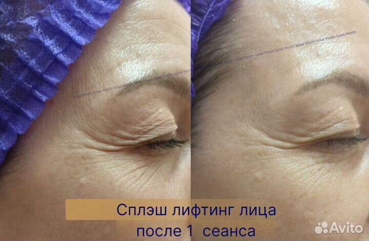 Массаж лица