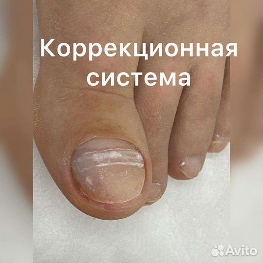 Медицинский педикюр. Подолог