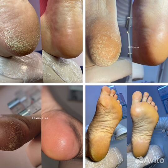 Маникюр, гель лак, наращивание и SMART педикюр