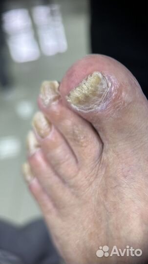 Курс подологии