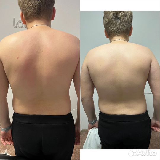 Массаж Северный