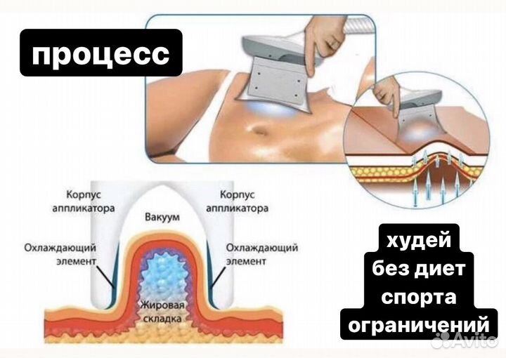 Похудение. Криолиполиз. Сушка тела