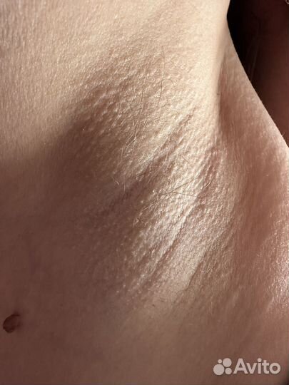 Шугаринг/Ваксинг