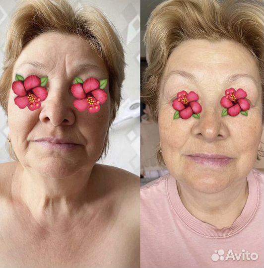 Массаж лица