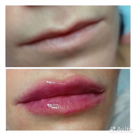 Услуги косметолога