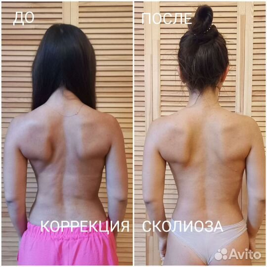 Лечебный массаж. Мягкие мануальные техники