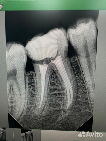 Врач стоматолог терапевт(универсал)