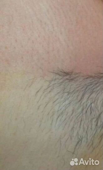 Депиляция Воск&Сахар