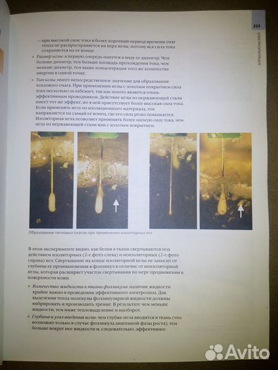 Энциклопедия эпиляции, книга по электроэпиляции