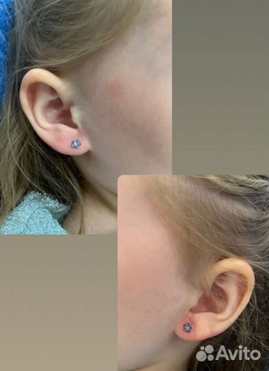 Прокол ушей система 75