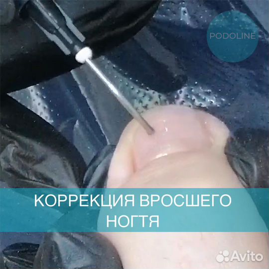 Подолог, вросший ноготь, грибок, отслоение