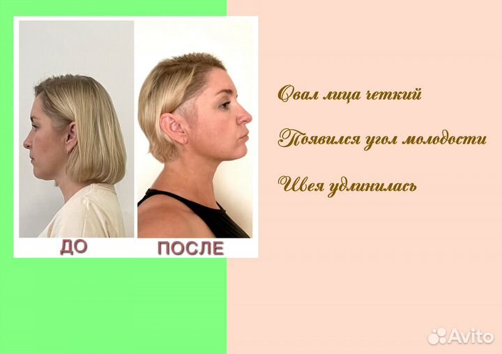 Гимнастика для лица фейспластика