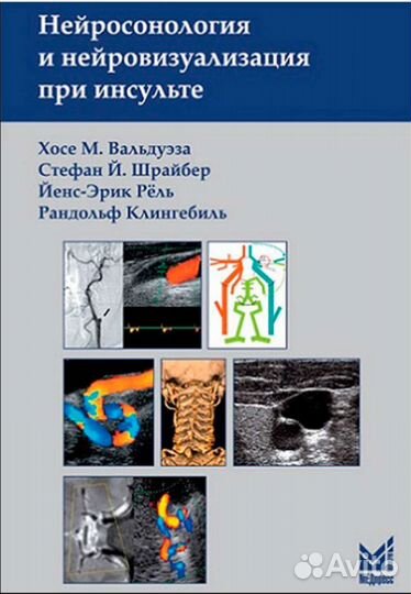Нейросонология и нейровизуализация. Вальдуэза Х