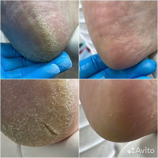 Педикюр серпухов