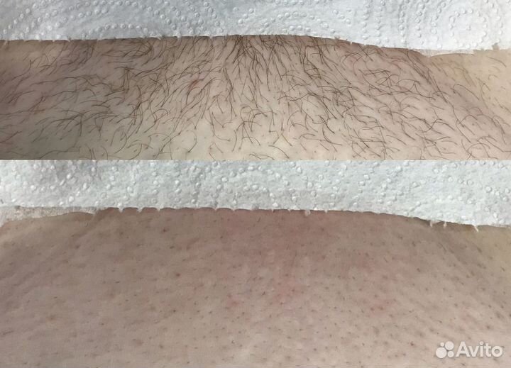 SPA-Шугаринг