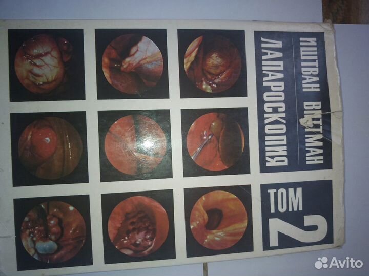 Лапароскопия в 2-х томах Иштван Виттман 1966 г