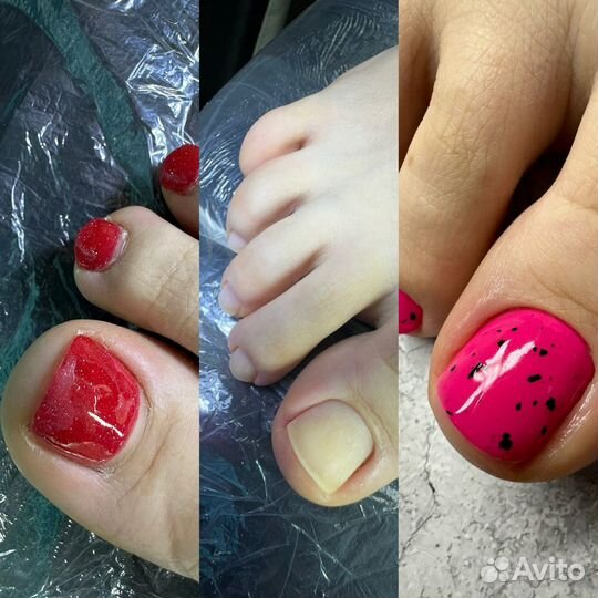 Модель на педикюр