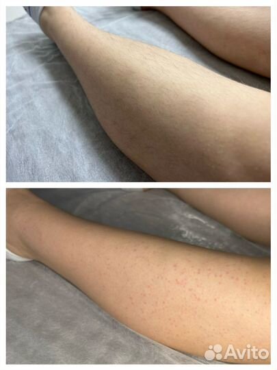 Мастер шугаринга