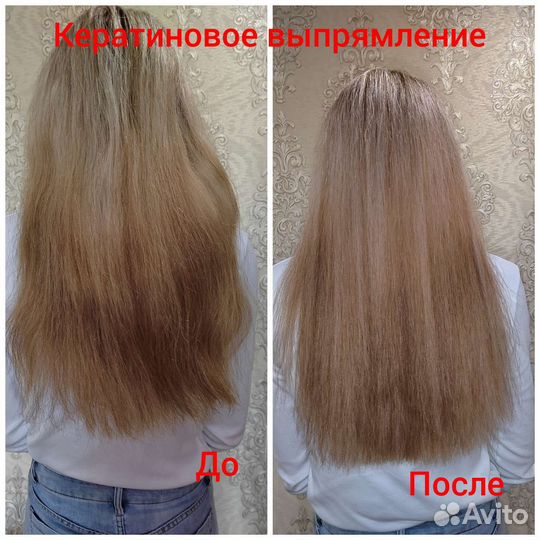 Лечение волос