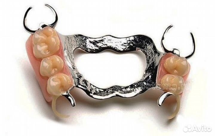 Срочный ремонт зубных протезов В Москве